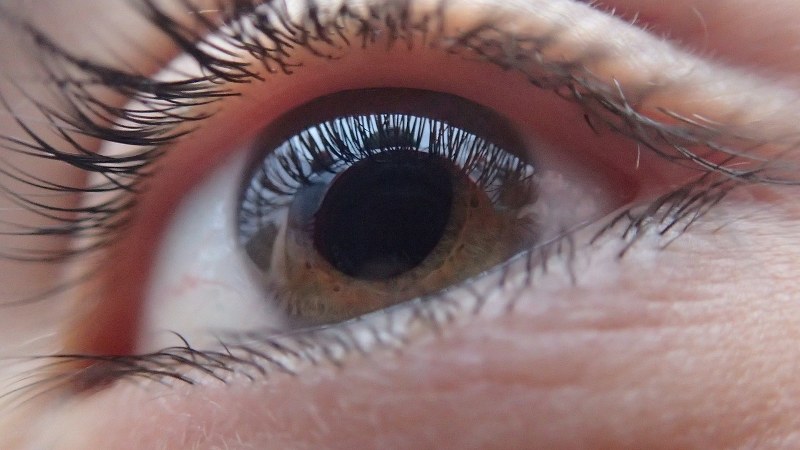 Cerchiaggio della retina, quali sono i tempi di recupero?